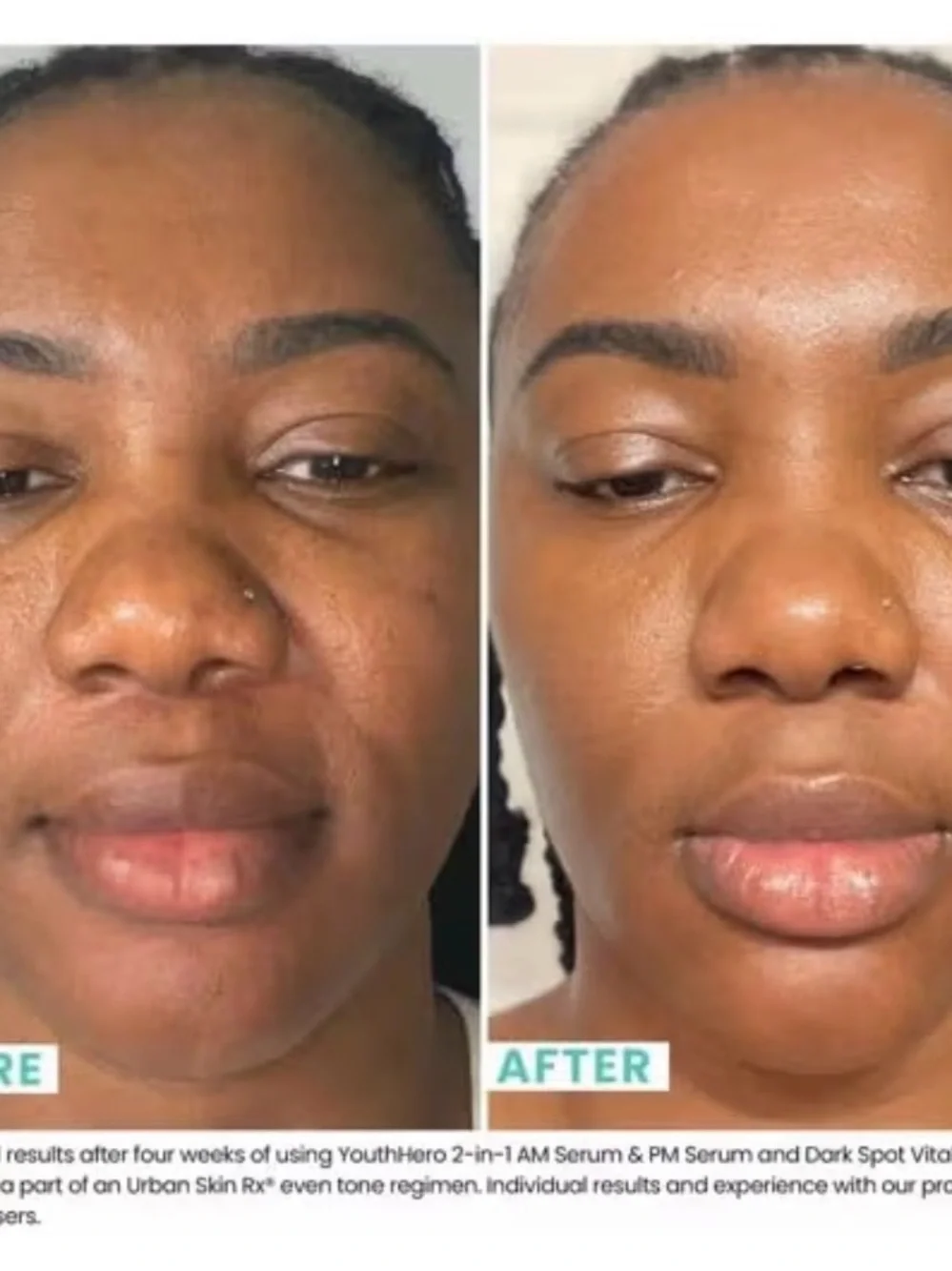 USRx Alpha Arbutin + 1% Retinoid Serum Duo — Green NIB